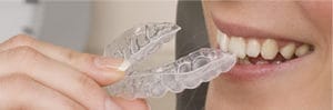 Stock Image of Invisalign