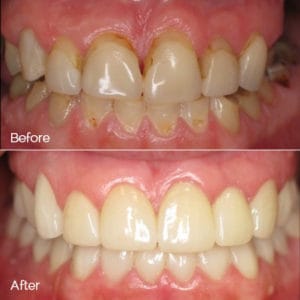 Case Study - Cosmetic Dentistry Before Image