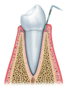 Illustration of Healthy Teeth and Gums