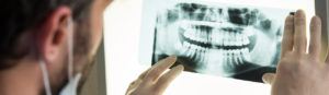 Stock Image of Dental X-Ray