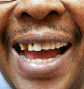 Case Study - Cosmetic Dentistry Before Image