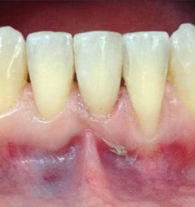 Case Study - Cosmetic Dentistry After Image