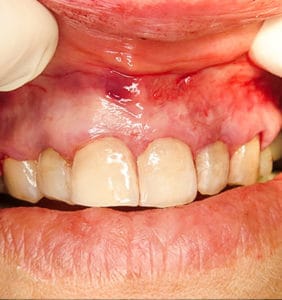 Case Study - Cosmetic Dentistry After Image