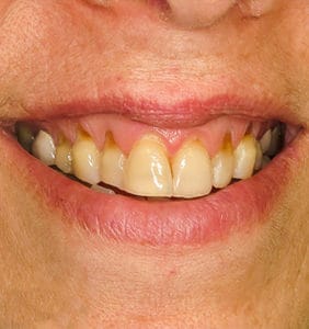 Case Study - Cosmetic Dentistry Before Image