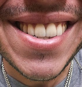 Case Study - Cosmetic Dentistry After Image