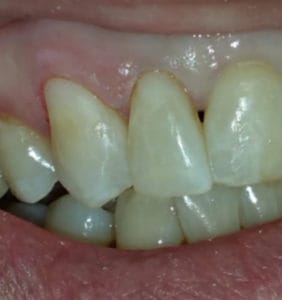 Case Study - Cosmetic Dentistry After Image