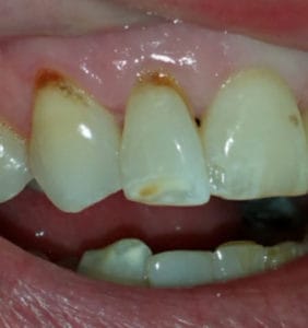 Case Study - Cosmetic Dentistry Before Image