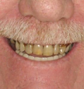 Case Study - Cosmetic Dentistry Before Image