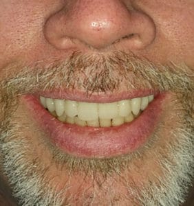 Case Study - Cosmetic Dentistry After Image