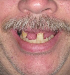 Case Study - Cosmetic Dentistry Before Image