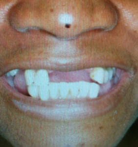 Case Study - Cosmetic Dentistry Before Image