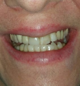 Case Study - Cosmetic Dentistry After Image