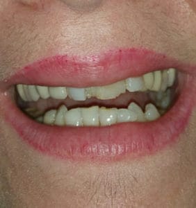 Case Study - Cosmetic Dentistry Before Image