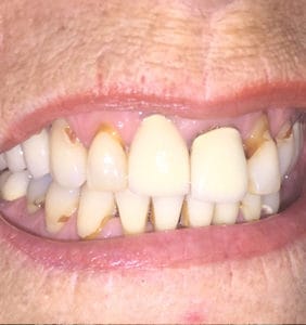 Case Study - Cosmetic Dentistry Before Image