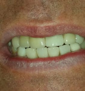 Case Study - Cosmetic Dentistry Before Image