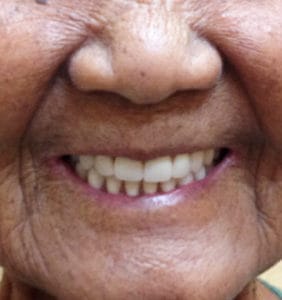 Case Study - Cosmetic Dentistry After Image