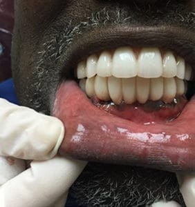 Case Study - Cosmetic Dentistry After Image