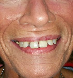 Case Study - Cosmetic Dentistry Before Image