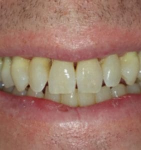 Case Study - Cosmetic Dentistry After Image