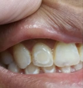 Case Study - Cosmetic Dentistry Before Image