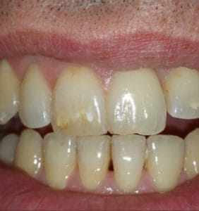 Case Study - Cosmetic Dentistry Before Image