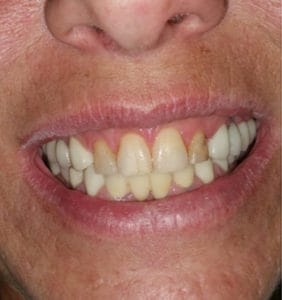 Case Study - Cosmetic Dentistry Before Image