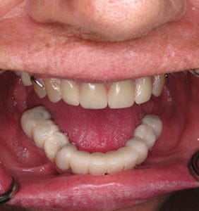 Case Study - Cosmetic Dentistry After Image