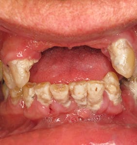 Case Study - Cosmetic Dentistry Before Image