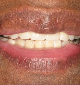 Case Study - Cosmetic Dentistry After Image
