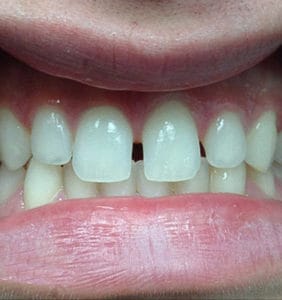 Case Study - Cosmetic Dentistry Before Image
