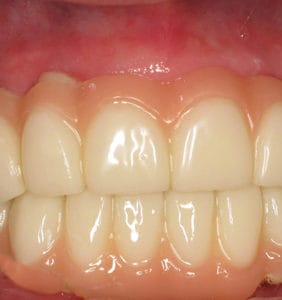 Case Study - Cosmetic Dentistry After Image