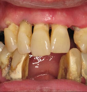 Case Study - Cosmetic Dentistry Before Image