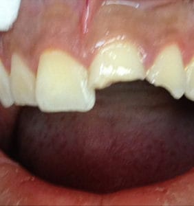 Case Study - Cosmetic Dentistry Before Image