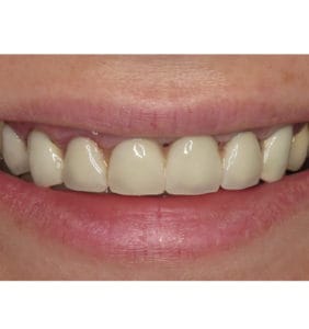 Case Study - Cosmetic Dentistry Before Image