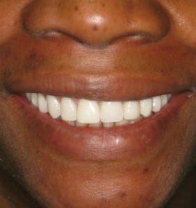 Clocktower Dental | Client Before & After Photos