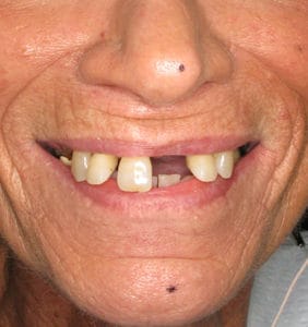Clocktower Dental | Client Before & After Photos