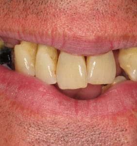 Case Study - Cosmetic Dentistry Before Image