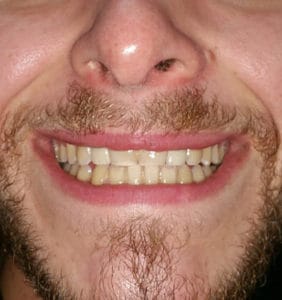 Case Study - Cosmetic Dentistry After Image