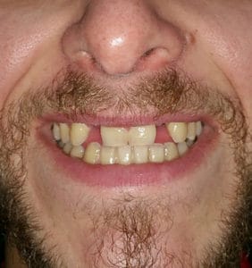 Case Study - Cosmetic Dentistry Before Image