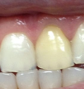 Case Study - Cosmetic Dentistry Before Image