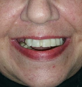 Case Study - Cosmetic Dentistry Before Image