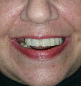 Case Study - Cosmetic Dentistry Before Image