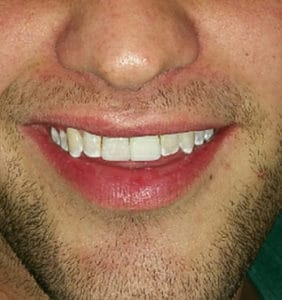 Case Study - Cosmetic Dentistry After Image