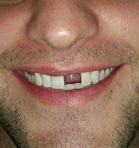 Case Study - Cosmetic Dentistry Before Image