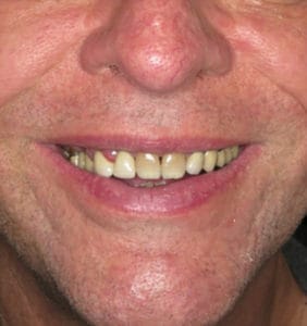 Case Study - Cosmetic Dentistry Before Image