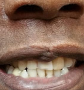 Case Study - Cosmetic Dentistry After Image