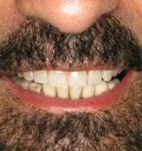 Case Study - Cosmetic Dentistry Before Image