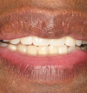 Case Study - Cosmetic Dentistry After Image
