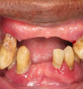 Case Study - Cosmetic Dentistry Before Image