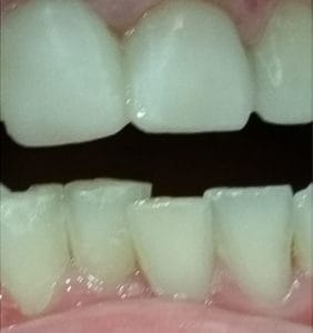 Case Study - Cosmetic Dentistry After Image